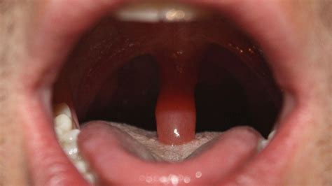 does your uvula touch your tongue